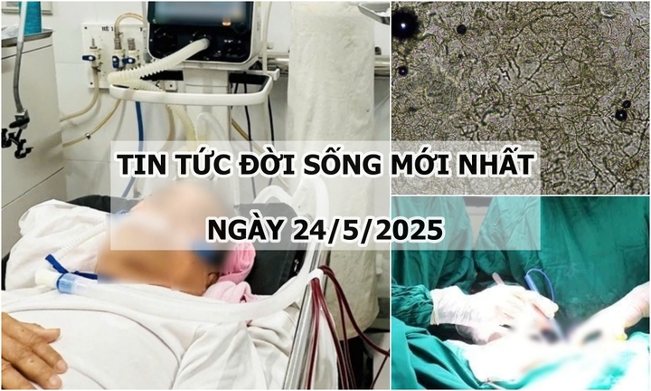 Tin tức đời sống 24/5: Ca mổ sinh tử giành lại sự sống cho người đàn ông 33 tuổi