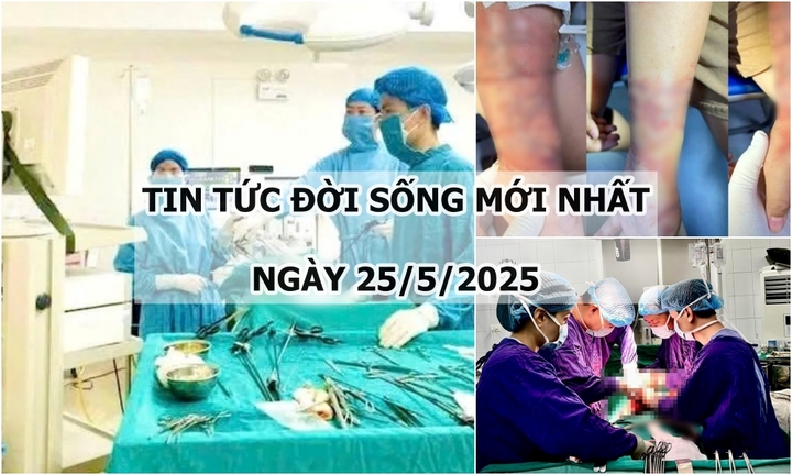 Tin tức đời sống 25/5: Bóc tách khối u chứa tóc, răng, sụn xương cho bệnh nhân 67 tuổi