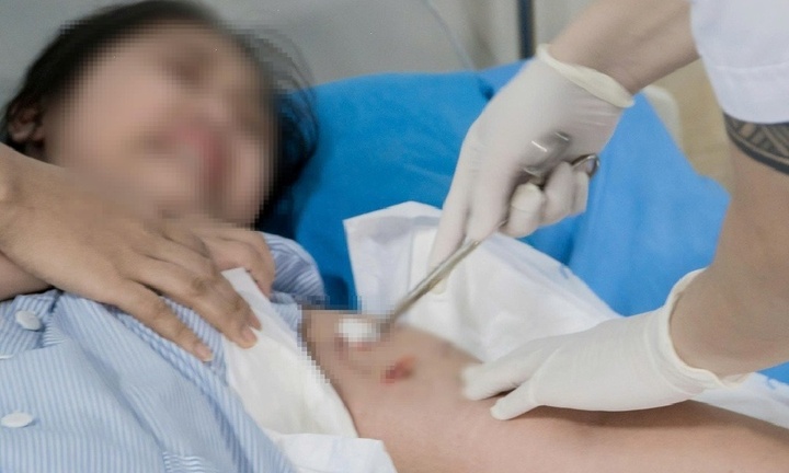 Bị chó nhà hàng xóm cắn, bé gái nhập viện với nhiều vết thương