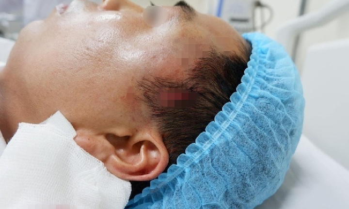Bi hài hậu vận sau thẩm mỹ: