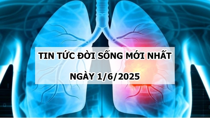 Tin tức đời sống 1/6: Đau họng kéo dài, đi khám phát hiện ung thư phổi di căn