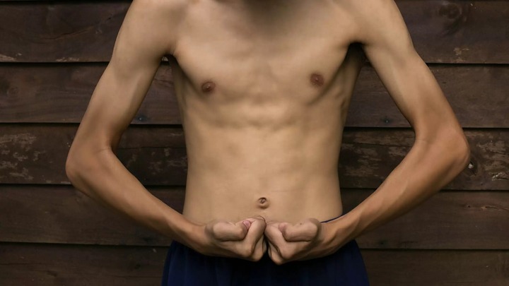 Vì sao người gầy vẫn mắc gan nhiễm mỡ?