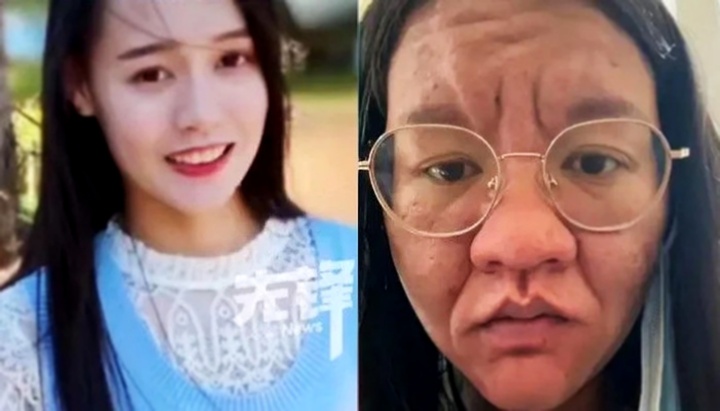 Cô gái gây sốc vì gương mặt thay đổi không nhận ra khi mang thai!