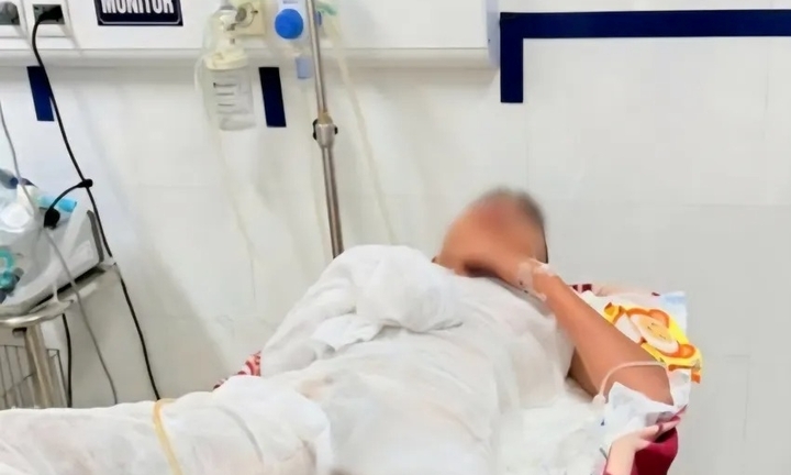Gỡ dây diều vướng vào đường điện cao thế, bé trai 12 tuổi bị điện giật bỏng nặng