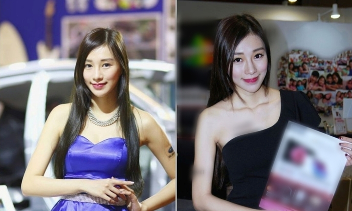 Thương tâm: Nữ người mẫu xinh đẹp tử vong sau khi chữa mất ngủ ở phòng khám thẩm mỹ