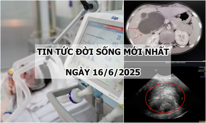 Tin tức đời sống 16/6: Người phụ nữ “sống chung” với khối u xơ tử cung 10 năm