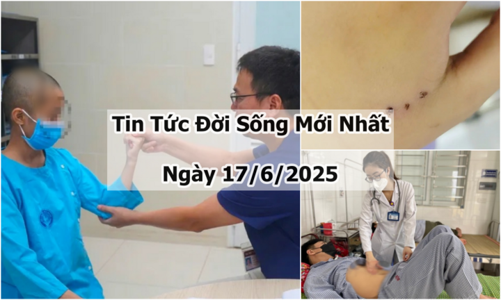 Tin tức đời sống 17/6: Cứu sống bé 13 tuổi bị xuất huyết não nghiêm trọng