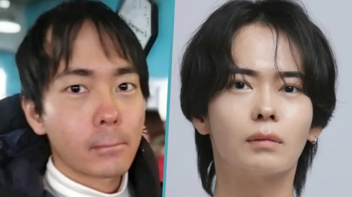 Bị bán gái chia tay vì đầu hói, người đàn ông 