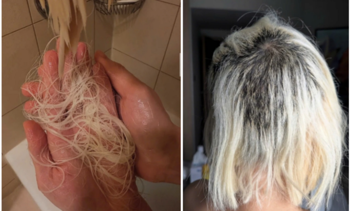 Nữ DJ nổi tiếng gặp sự cố khi làm đẹp, tóc rụng từng nắm lớn mỗi ngày, buồn đến mất ngủ