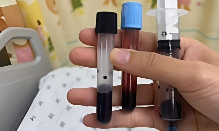 Bé gái ở Long An nguy kịch, tím tái nghi sau khi ăn canh nấu bằng nước giếng