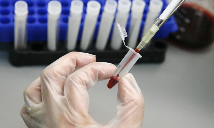 Đột phá: Phát hiện nhóm máu mới, chỉ duy nhất một người sở hữu trên thế giới