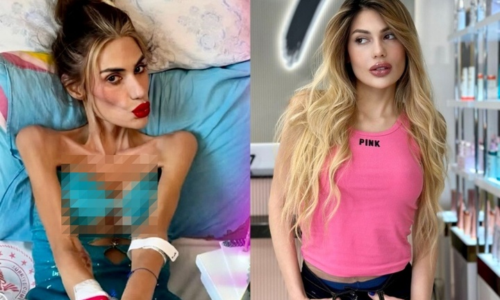 Mắc chứng biếng ăn, mỹ nhân truyền hình giảm 40kg trong 2 năm, qua đời thương tâm ở tuổi 30