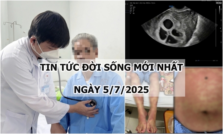 Tin tức đời sống 5/7: Cứu sống người đàn ông 63 tuổi bị ngừng tim, ngừng thở