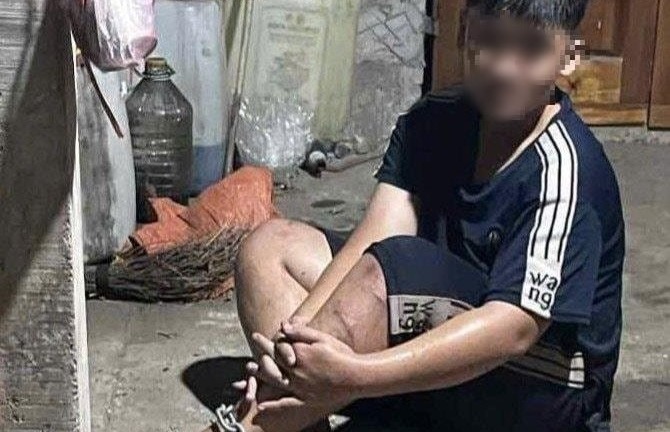 Xác minh thông tin thiếu niên 14 tuổi bị người đàn ông xích chân rồi hành hung