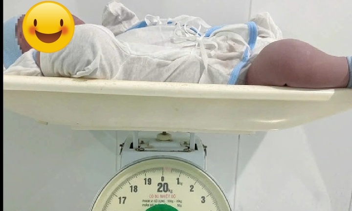 Bé sơ sinh nặng gần 6kg chào đời khỏe mạnh ở Cà Mau