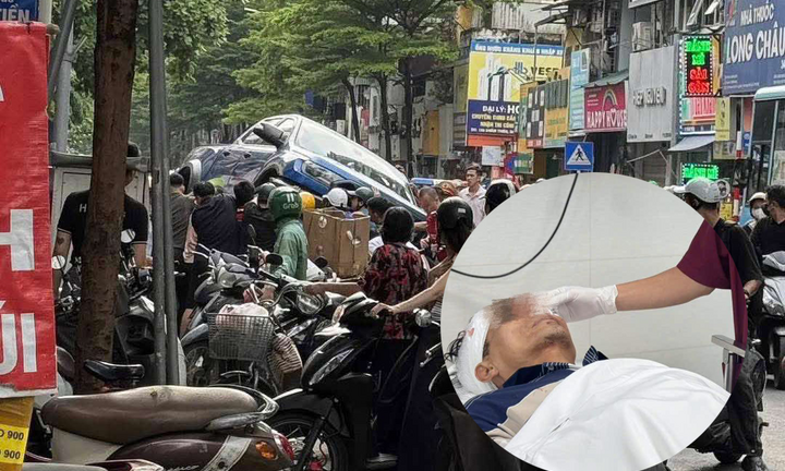 Vụ tai nạn ở phố Khâm Thiên: Nạn nhân phải phẫu thuật do chấn thương sọ não