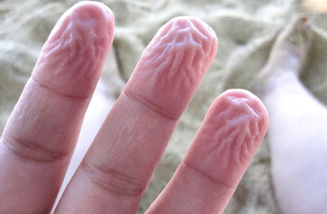 Tại sao ngón tay bị nhăn nheo khi ngâm nước lâu?