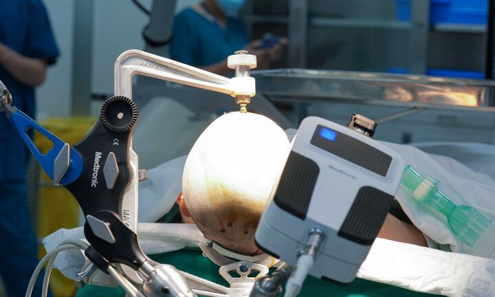Vinmec tiên phong điều trị động kinh bằng Robot định vị thần kinh hàng đầu thế giới