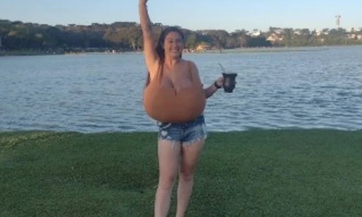 Cô gái 22 tuổi mắc bệnh 