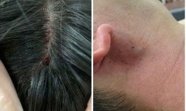 Xôn xao mẹo 