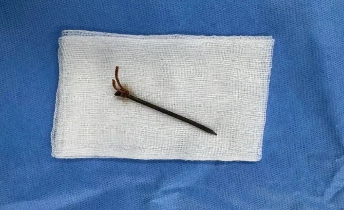 Người đàn ông 49 tuổi nhập viện vì tai nạn hi hữu khi thi công công trình