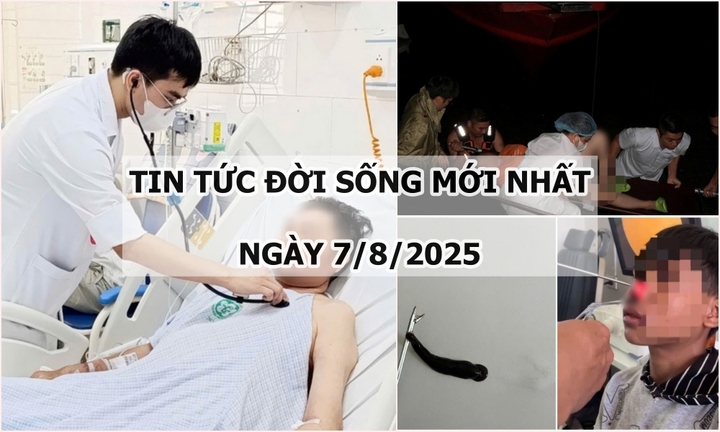 Tin tức đời sống 7/8: Người đàn ông nguy kịch sau khi bị một sinh vật đốt lúc tắm biển