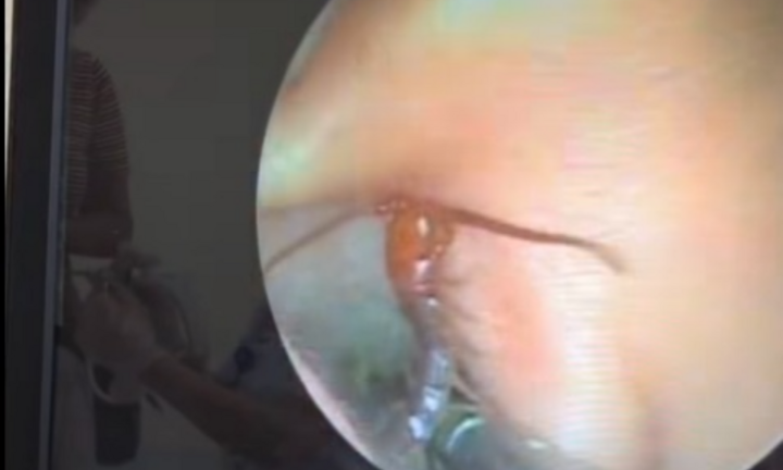 Bác sĩ phát hiện 