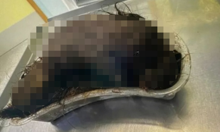 Con gái đau bụng dai dẳng suốt 6 tháng, mẹ đưa đi khám thì phát hiện 