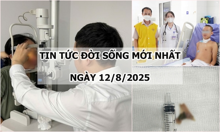 Tin tức đời sống 12/8: Xương vịt dài 2cm mắc trong thực quản bé 12 tuổi
