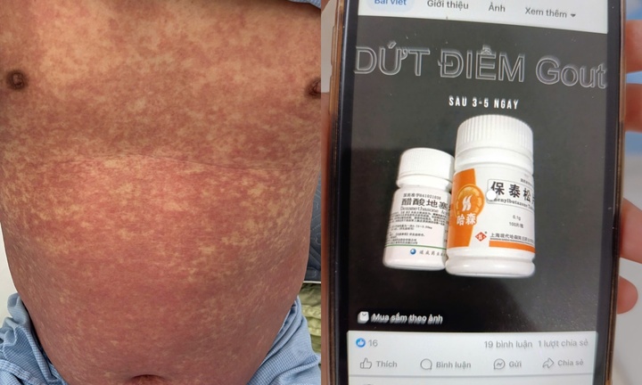 Uống thuốc cấm 