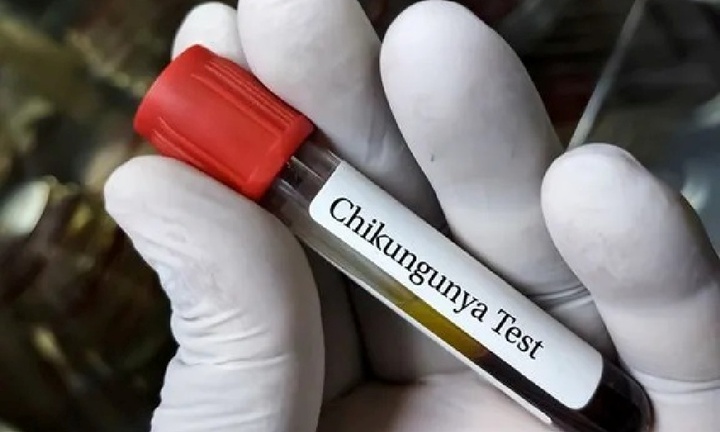 Chikungunya khiến bé trai 12 ngày tuổi ở Ấn Độ mặt tím đen, phải nhập viện cấp cứu khẩn