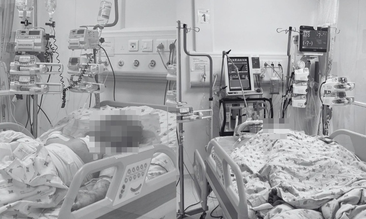 Hai chị em bị bỏng nặng, nghi do cha ruột phóng hỏa, bé trai tiên lượng dè dặt