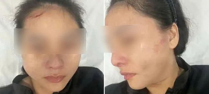 Vụ cô gái bị chủ nhà hành hung ở TP.HCM: Nạn nhân chưa hết ám ảnh, từng bị đe dọa và tấn công