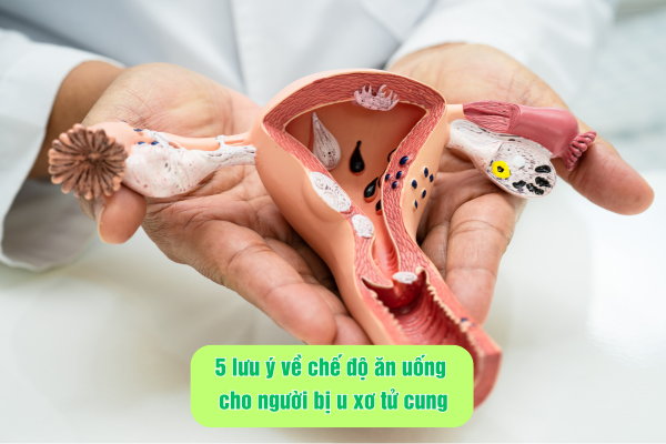 5 lưu ý về chế độ ăn uống cho người bị u xơ tử cung