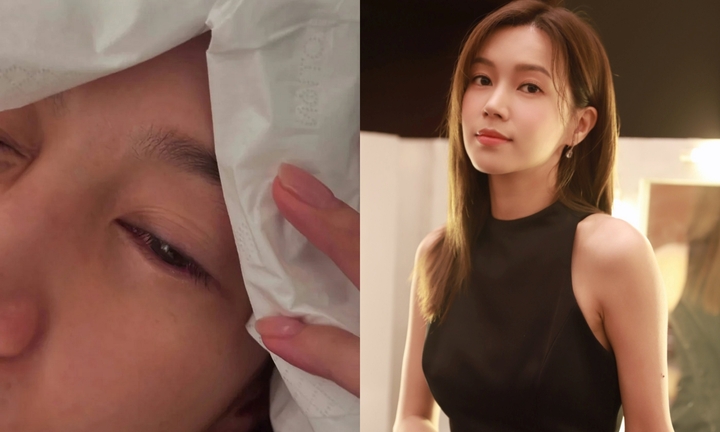 Nữ diễn viên không may bị rách giác mạc, nhập viện cấp cứu giữa đêm