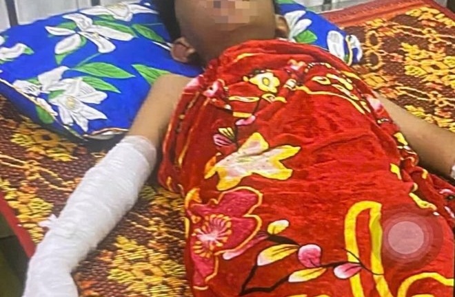 Học sinh lớp 5 ở Quảng Trị nhập viện do vật lạ phát nổ 