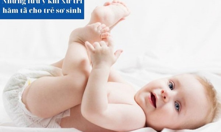 Những lưu ý khi xử trí hăm tã cho trẻ sơ sinh