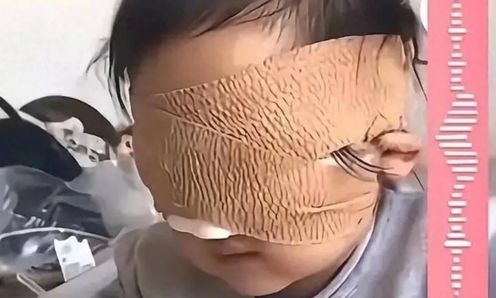 Bé gái mù cả hai mắt do thói quen nhìn chằm chằm vào điện thoại và máy tính bảng