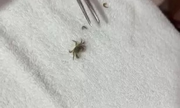 Clip: Đưa con trai đi khám vì đau tai, mẹ sửng sốt khi thấy thứ được tìm thấy bên trong