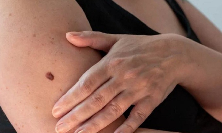 Nếu cơ thể xuất hiện dấu hiệu này chứng tỏ gan đang cầu cứu