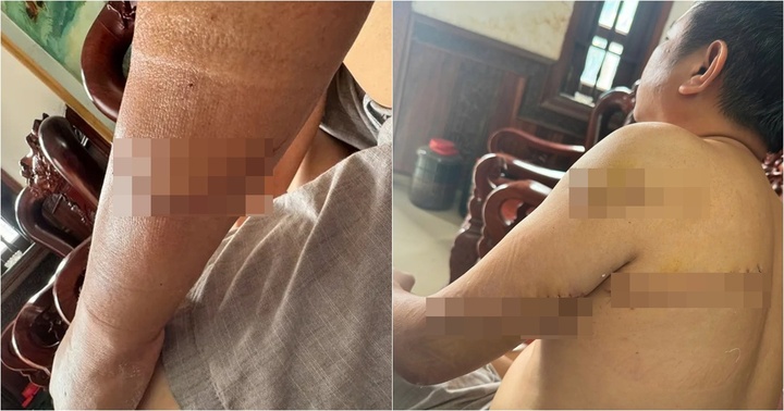 Danh tính 3 nghi phạm truy sát người đàn ông ở Đồng Nai