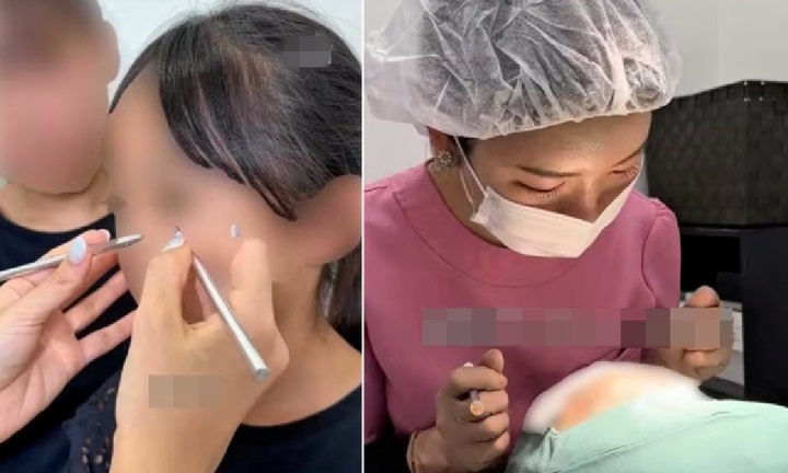 Clip cắt mí cho bé gái tiểu học gây phẫn nộ, thẩm mỹ viện ở Nhật Bản hứng 