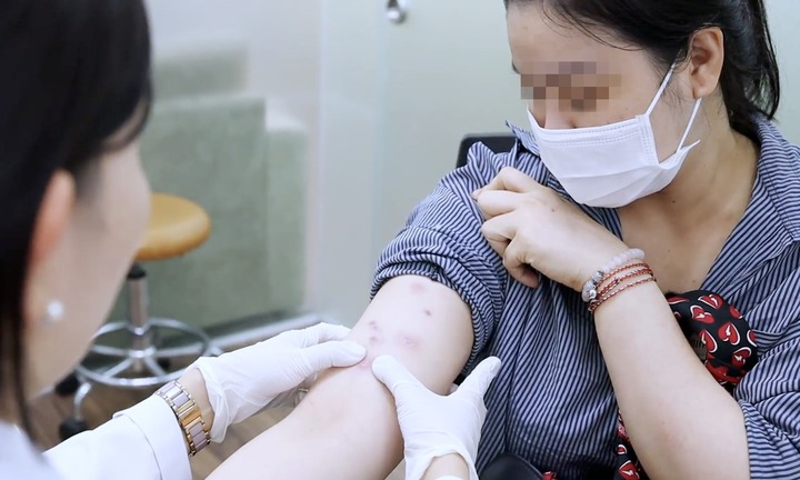 Tin tức đời sống 11/10: Cơ thể biến dạng nặng nề sau khi tiêm tan mỡ trôi nổi