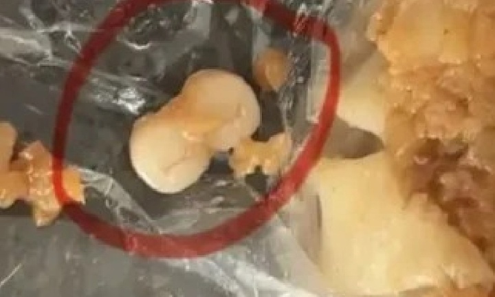 Trung Quốc: Đang ăn bánh bao, người dân vội vàng báo cảnh sát khi thấy vật lạ bên trong