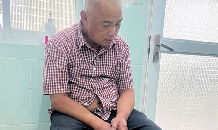 Tạm giữ hình sự Đoàn Thanh Hùng - đối tượng tấn công Đại úy công an ở Lạng Sơn