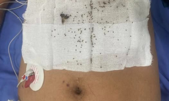 Bị hơn 300 con ong tấn công, người đàn ông hôn mê, suy đa cơ quan