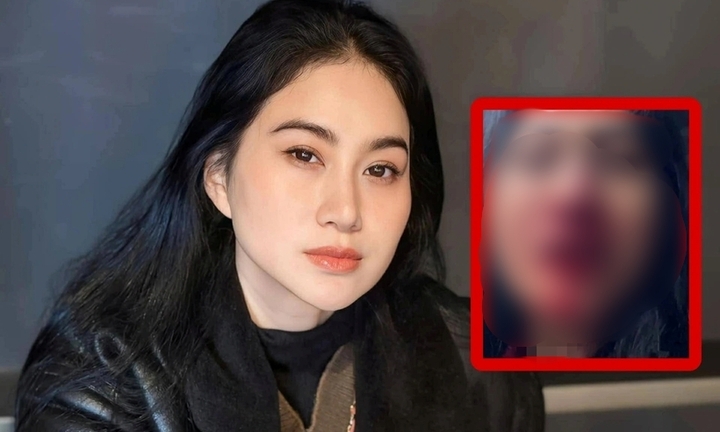 Diễn viên Phi Ngọc Ánh bất ngờ cầu cứu qua livestream