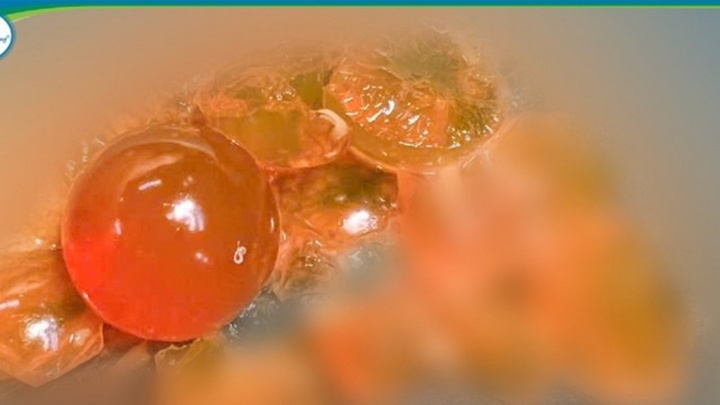 Tin tức đời sống 2/11: Bé trai 14 tháng tuổi nôn liên tục, bác sĩ 