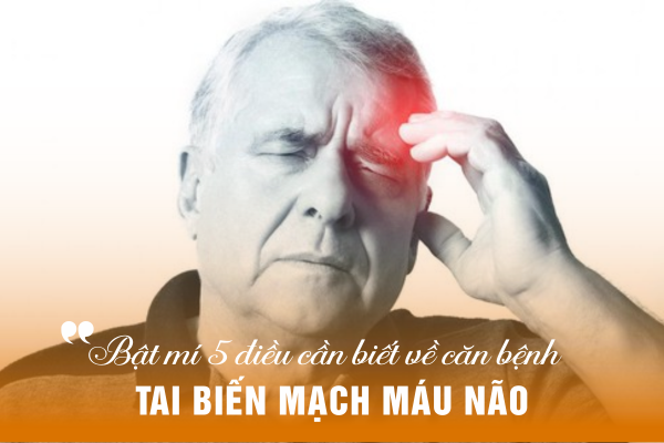 Bật mí 5 điều cần biết về căn bệnh tai biến mạch máu não