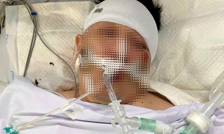 Tông trúng chó chạy rông sang đường, nam thanh niên đi xe máy nguy kịch